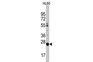 Image no. 1 for anti-Lin-28 Homolog B (LIN28B) (C-Term) antibody (ABIN357012)