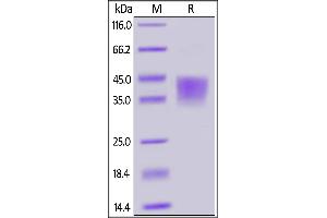 Image no. 1 for CD28 (CD28) (AA 19-152) (Active) protein (His tag) (ABIN6388262)