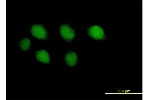 Image no. 1 for anti-Polymerase (DNA Directed), Epsilon, Catalytic Subunit (POLE) (AA 1-370) antibody (ABIN519022)