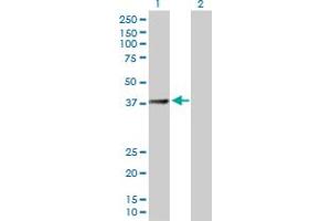 Image no. 1 for anti-Succinate-CoA Ligase, GDP-Forming, beta Subunit (SUCLG2) (AA 1-384) antibody (ABIN522249)