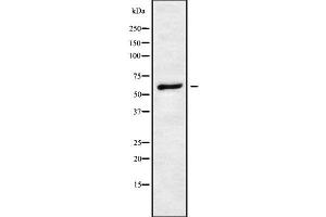 Image no. 1 for anti-Cleavage and Polyadenylation Specific Factor 6, 68kDa (CPSF6) (Internal Region) antibody (ABIN6261008)