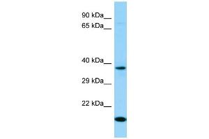 Image no. 1 for anti-Olfactory Receptor, Family 7, Subfamily D, Member 4 (OR7D4) (C-Term) antibody (ABIN2790664)