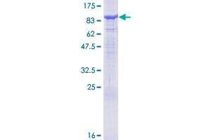 Image no. 1 for Sphingosine Kinase 2 (SPHK2) (AA 1-654) protein (GST tag) (ABIN1321164)