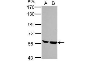 Image no. 1 for anti-Hematopoietic Cell-Specific Lyn Substrate 1 (HCLS1) (C-Term) antibody (ABIN2854705)