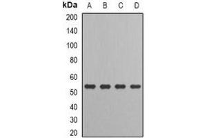 Image no. 1 for anti-Interferon Regulatory Factor 6 (IRF6) antibody (ABIN2966748)