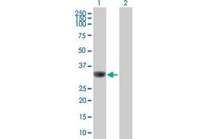 Image no. 3 for anti-Survival of Motor Neuron 2, Centromeric (SMN2) (AA 1-282) antibody (ABIN520302)