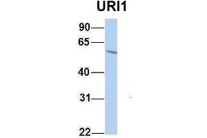 Image no. 2 for anti-URI1, Prefoldin-Like Chaperone (URI1) (Middle Region) antibody (ABIN2784320)