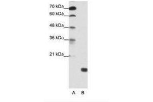Image no. 1 for anti-TGFB-Induced Factor Homeobox 2-Like, Y-Linked (TGIF2LY) (AA 99-148) antibody (ABIN203023)