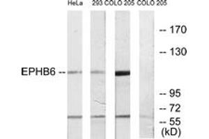 Image no. 1 for anti-EPH Receptor B6 (EPHB6) (AA 861-910) antibody (ABIN1533496)
