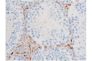 Image no. 6 for anti-Spleen tyrosine Kinase (SYK) (pTyr348) antibody (ABIN6255895)