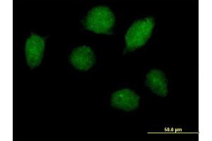 Image no. 2 for anti-Homeobox A1 (HOXA1) (AA 1-335) antibody (ABIN516595)