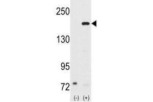 Image no. 2 for anti-Nuclear Receptor Coactivator 1 (NCOA1) (AA 186-214) antibody (ABIN3032056)