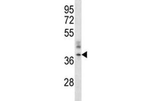 Image no. 1 for anti-ORAI Calcium Release-Activated Calcium Modulator 1 (ORAI1) (AA 269-298) antibody (ABIN3028903)