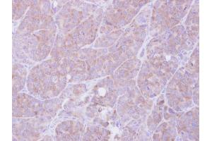 IHC-P Image Immunohistochemical analysis of paraffin-embedded SW480 xenograft, using MIF, antibody at 1:500 dilution.