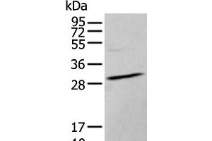 Western blot analysis of TM4 cell lysate using HOXC9 Polyclonal Antibody at dilution of 1:350