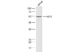 Image no. 1 for anti-Neuroepithelial Cell Transforming 1 (NET1) antibody (ABIN873108)
