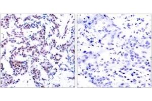 Image no. 2 for anti-Jun B Proto-Oncogene (JUNB) (AA 226-275), (pSer259) antibody (ABIN1531891)
