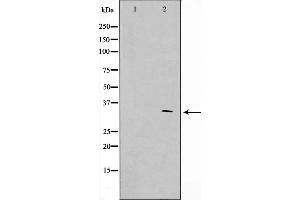 Image no. 2 for anti-Adenomatous Polyposis Coli (APC) (Internal Region) antibody (ABIN6259974)