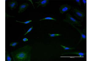 Image no. 2 for anti-Mitochondrial Ribosomal Protein L1 (MRPL1) (AA 1-303) antibody (ABIN528766)