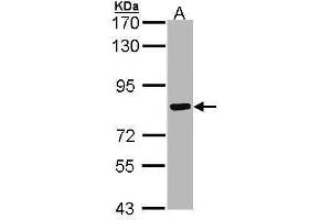 Image no. 2 for anti-Cortactin (CTTN) (N-Term) antibody (ABIN2854674)