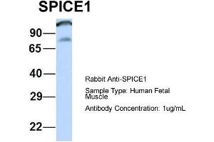 Image no. 1 for anti-Spindle and Centriole Associated Protein 1 (SPICE1) (Middle Region) antibody (ABIN2774026)