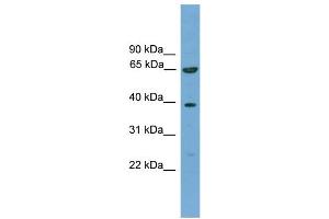 Image no. 1 for anti-Kelch-Like 20 (KLHL20) (C-Term) antibody (ABIN2774097)
