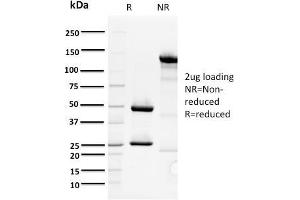 Image no. 1 for anti-Origin Recognition Complex, Subunit 1 (ORC1L) antibody (ABIN6940243)