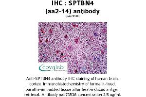Image no. 2 for anti-Spectrin Beta, Non-Erythrocytic 4 (SPTBN4) (AA 2-14) antibody (ABIN1739626)