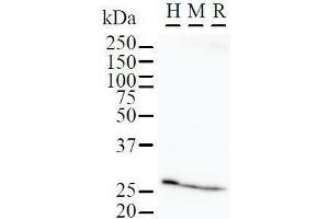 Image no. 2 for anti-FK506 Binding Protein 3, 25kDa (FKBP3) antibody (ABIN933115)