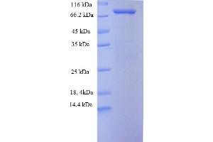 Image no. 1 for Stress-Induced-phosphoprotein 1 (STIP1) (AA 1-543), (full length) protein (His-SUMO Tag) (ABIN5710426)