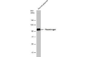 Image no. 6 for anti-Plasminogen (PLG) (Center) antibody (ABIN2855505)