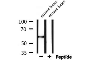 Image no. 3 for anti-Perilipin 1 (PLIN1) antibody (ABIN6264141)