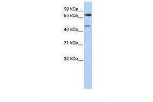 Image no. 1 for anti-Denticleless E3 Ubiquitin Protein Ligase Homolog (DTL) (AA 182-231) antibody (ABIN6738232)