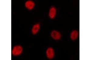 Image no. 1 for anti-Polo-Like Kinase 5 (PLK5) (Internal Region) antibody (ABIN6259479)