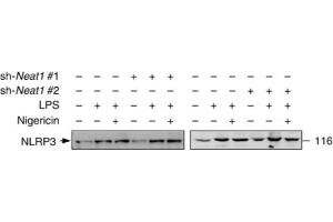 Image no. 5 for anti-NLR Family, Pyrin Domain Containing 3 (NLRP3) (AA 1-93), (Pyrin Domain) antibody (ABIN1169100)