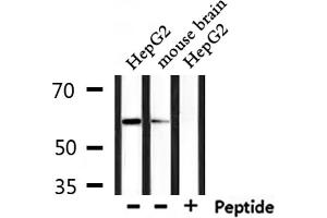 Image no. 3 for anti-Caspase 10, Apoptosis-Related Cysteine Peptidase (CASP10) antibody (ABIN6260480)