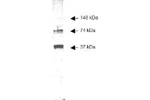 Image no. 1 for anti-Alcohol Dehydrogenase 1 (Class I) (ADH1) antibody (ABIN116588)