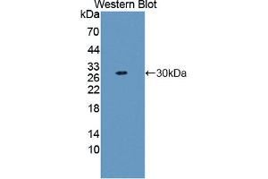 Image no. 2 for anti-E3 Ubiquitin-protein ligase DTX1 (DTX1) (AA 290-535) antibody (ABIN5013444)