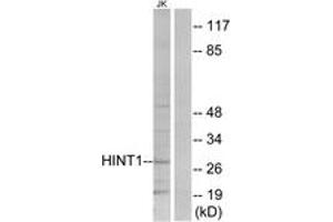 Image no. 1 for anti-Histidine Triad Nucleotide Binding Protein 1 (HINT1) (AA 71-120) antibody (ABIN1533751)