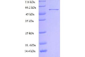 Image no. 1 for rho Guanine Nucleotide Exchange Factor (GEF) 7 (ARHGEF7) (AA 1-250), (partial) protein (GST tag) (ABIN5712151)