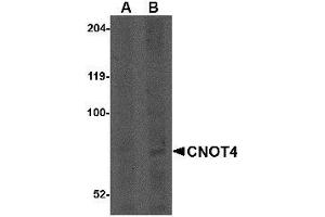 Image no. 1 for anti-CCR4-NOT Transcription Complex Subunit 4 (CNOT4) (N-Term) antibody (ABIN499646)