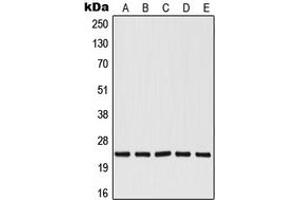 Image no. 1 for anti-V-Ral Simian Leukemia Viral Oncogene Homolog B (Ras Related, GTP Binding Protein) (Ralb) (Center) antibody (ABIN2706924)