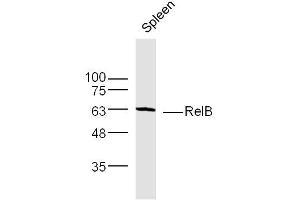 Image no. 1 for anti-V-Rel Reticuloendotheliosis Viral Oncogene Homolog B (RELB) (AA 161-260) antibody (ABIN755083)