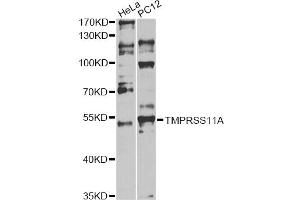 anti-Transmembrane Protease, Serine 11A (TMPRSS11A) antibody