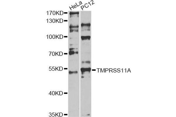 anti-Transmembrane Protease, Serine 11A (TMPRSS11A) antibody
