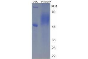 Image no. 3 for Parathyroid Hormone (PTH) peptide (Ovalbumin) (ABIN5666321)