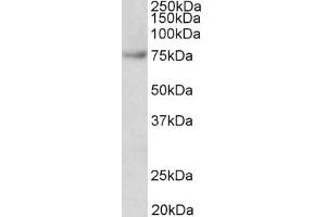 Image no. 2 for anti-Far Upstream Element (FUSE) Binding Protein 1 (FUBP1) (AA 160-174) antibody (ABIN5539722)