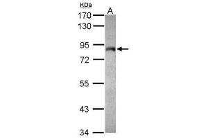 Image no. 1 for anti-MYST Histone Acetyltransferase 2 (MYST2) (Internal Region) antibody (ABIN2855265)