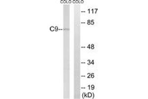 Image no. 1 for anti-Complement Component C9 (C9) (AA 181-230) antibody (ABIN1534796)