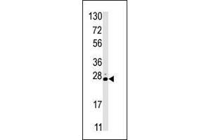 Image no. 1 for anti-serine/threonine Kinase 19 (STK19) (C-Term) antibody (ABIN359371)